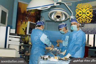 جراحی اسلیو مشهد | دکتر سجاد نورشفیعی | جراحی اسلیو معده | جراحی کیسه صفرا | جراحی فتق