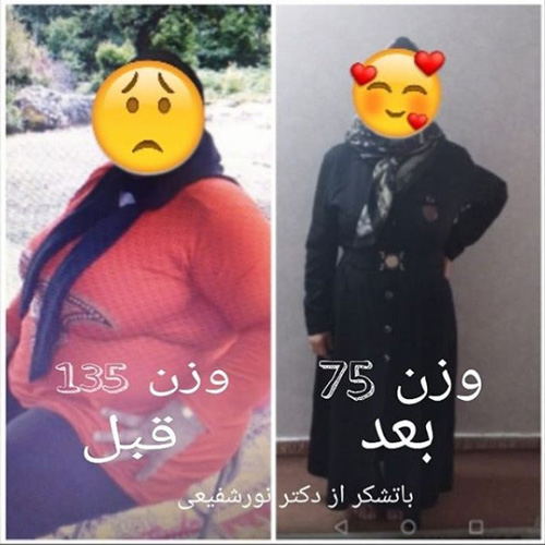 جراحی لاغری دکتر سجاد نور شفیعی هزینه جراحی لاغری | شرایط جراحی لاغری | جراحی لاغری چیست | جراحی لاپاراسکوپی جراحی لاغری | جراحی فتق مشهد | عمل جراحی لاغری